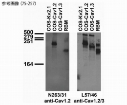 0120-ij-ge]一次抗体(NeuroMab) GIT1+belloprint.com